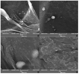 Design, Development and Stability Optimization of Targeted Doxorubicin-Loaded Liposomes 