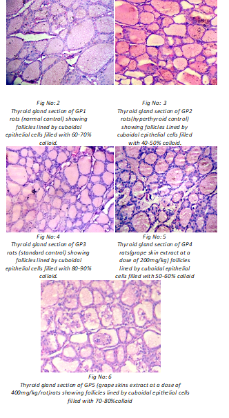 Image for <b>Anti Thyroid and AntiOxidant Effects of Grape Skin Extract on L-Thyroxine Induced Hyperthyroidism in Rats</b><p style="text-align: justify;"></p>
