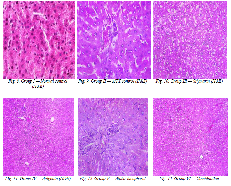 Comparative Evaluation of Hepatoprotective Activity of Apigenin and Alpha-Tocopherol Against Methotrexate-Induced Hepatotoxicity in Rats