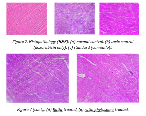 EVALUATION OF CARDIPROTECTIVE ACTIVITY OF RUTIN PHYTOSOME AGAINST DOXURUBICIN INDUCED CARDIOTOXICITY BY USING ANIMAL MODELS