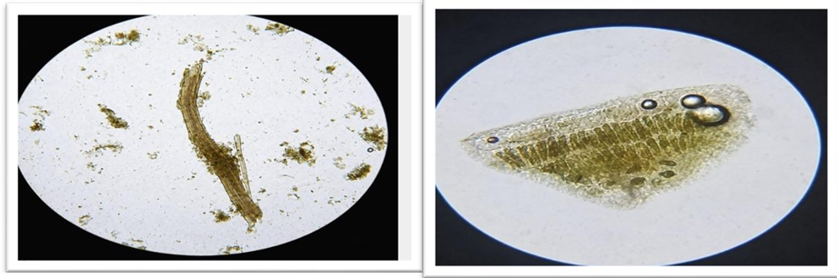 Pharmacognosy, Phytochemical and In-Vitro Thrombolytic Activity of leaves of Artabotrys hexapetalus